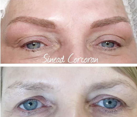 DOES MICROBLADING PREVENT HAIR GROWTH? - Beauty Ink